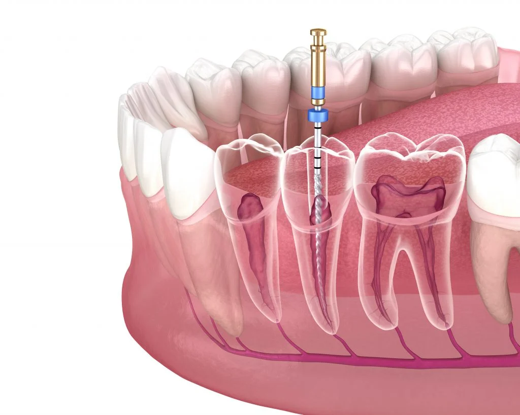 sermadent-img